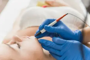 Професійне навчання електроепіляції в Тернополі: Ваша нова кар’єра з Lazerka.org